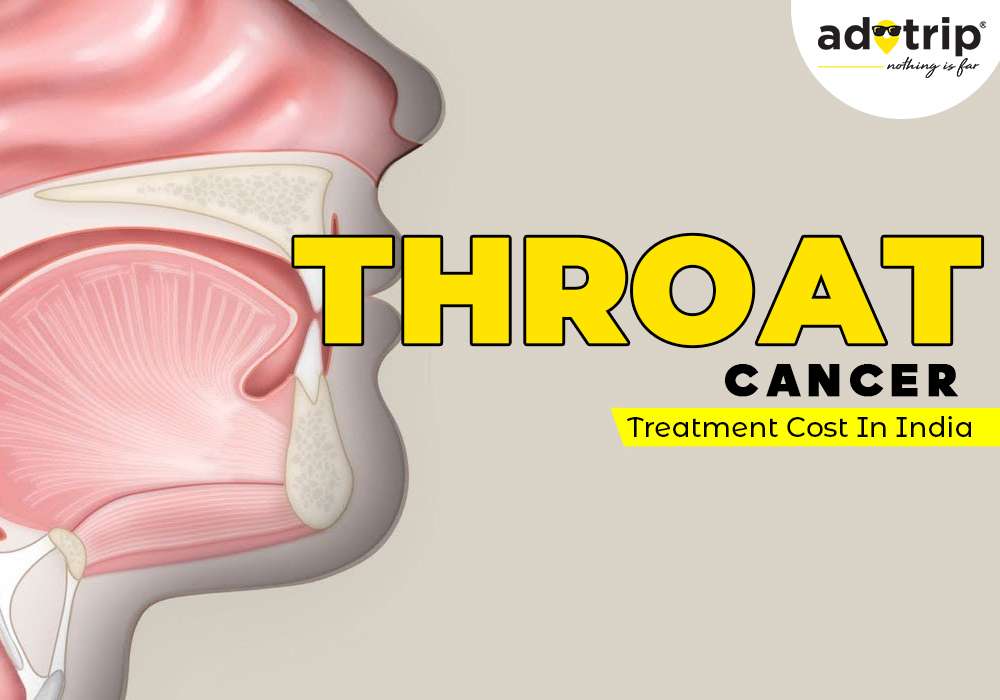 throat cancer treatment cost in india